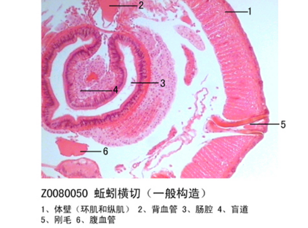 蚯蚓橫切（一般構(gòu)造）