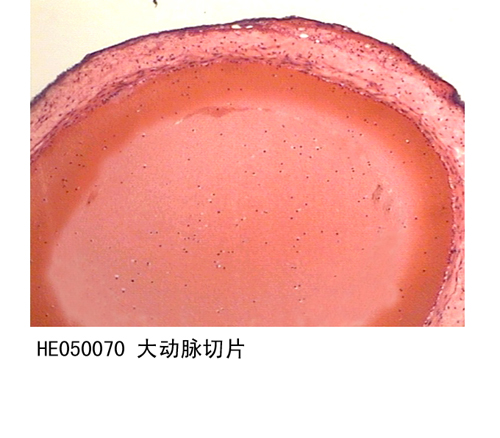 循環(huán)系統(tǒng)