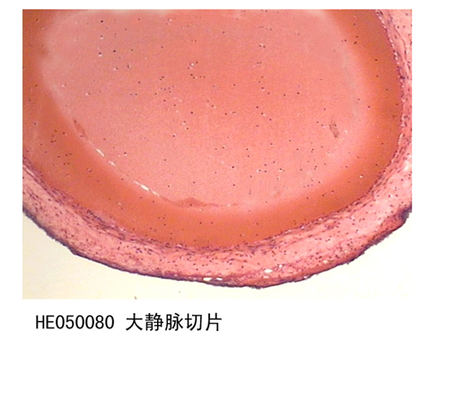 循環(huán)系統(tǒng)
